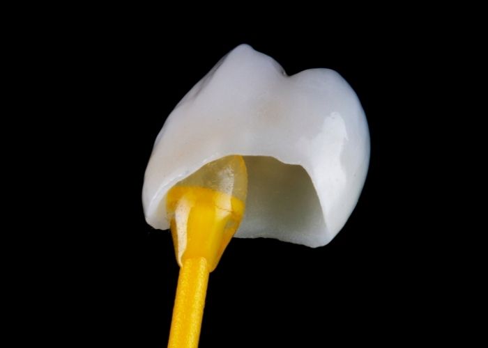 dental crowns near me