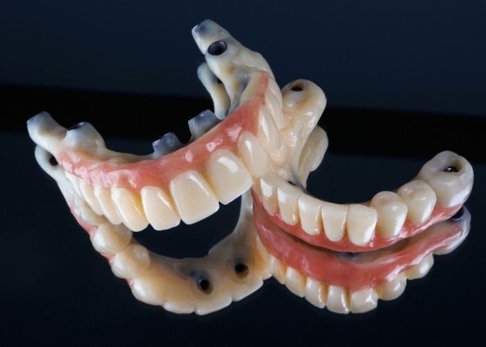 fixed partial denture plymouth