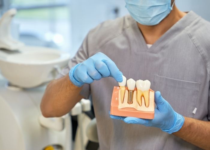 dental implants near me
